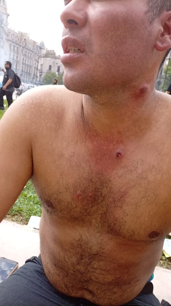 Reforma laboral: “Lo que se pierde peleando se termina ganando”